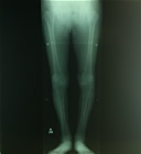 下肢X線画像