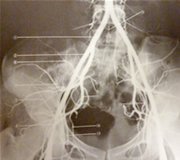 骨盤内の血液の流れ