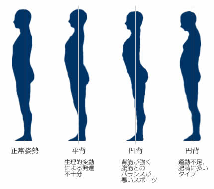 姿勢の分類図