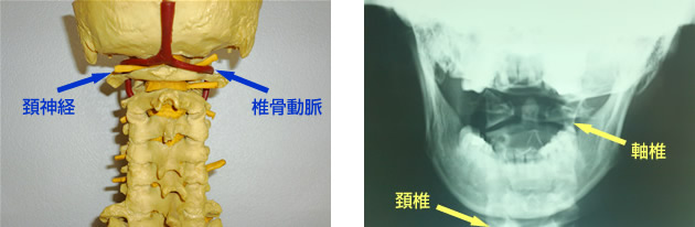 頚神経・椎骨動脈 頚椎・軸椎